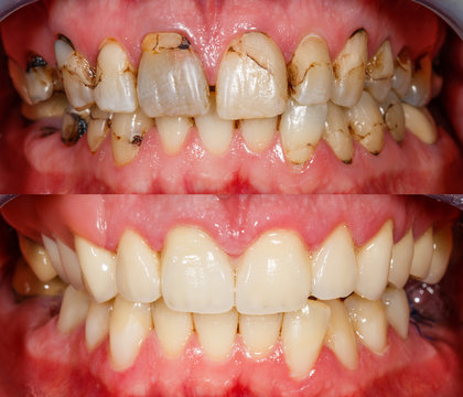 Dr. Christy Chen, Dds - A+ Dental photo 4