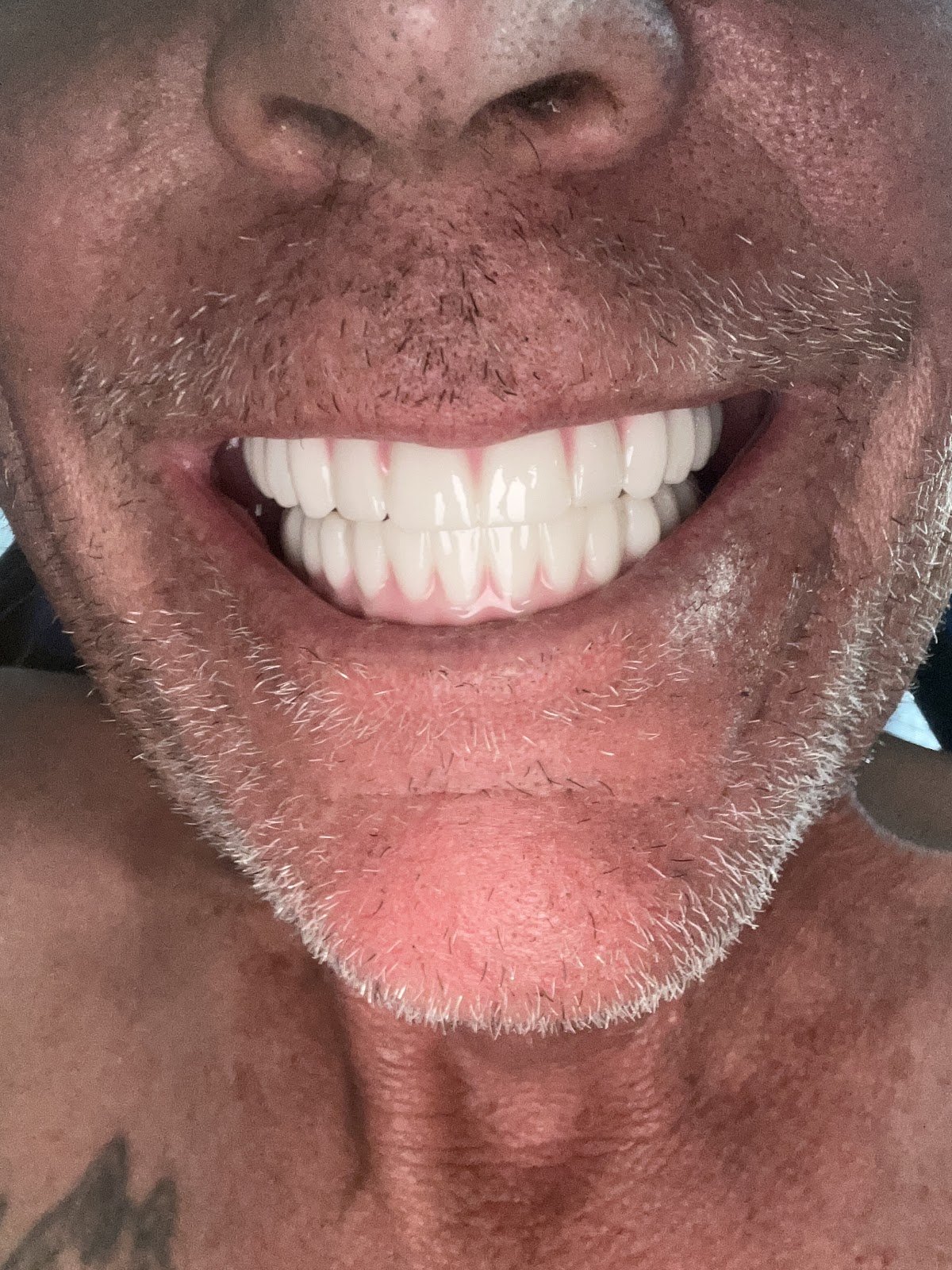 New Life Dental Implant Center photo 2