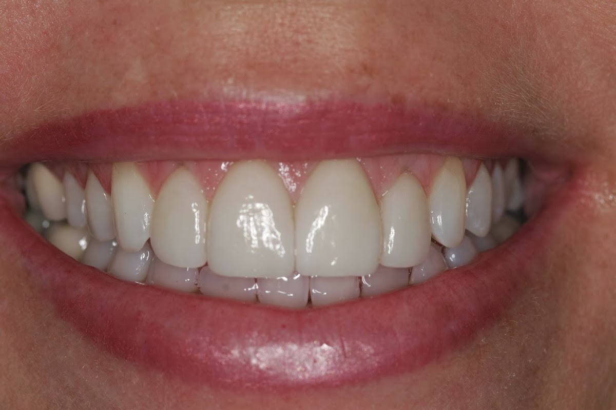 Dental Care Associates: Nathan Deeter DDS photo 2
