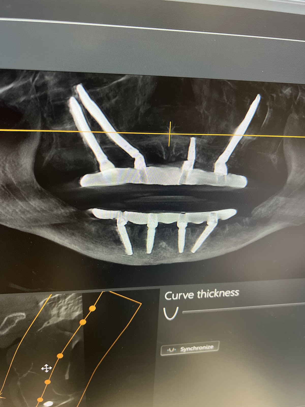 Digital Dental Implant Center photo 1