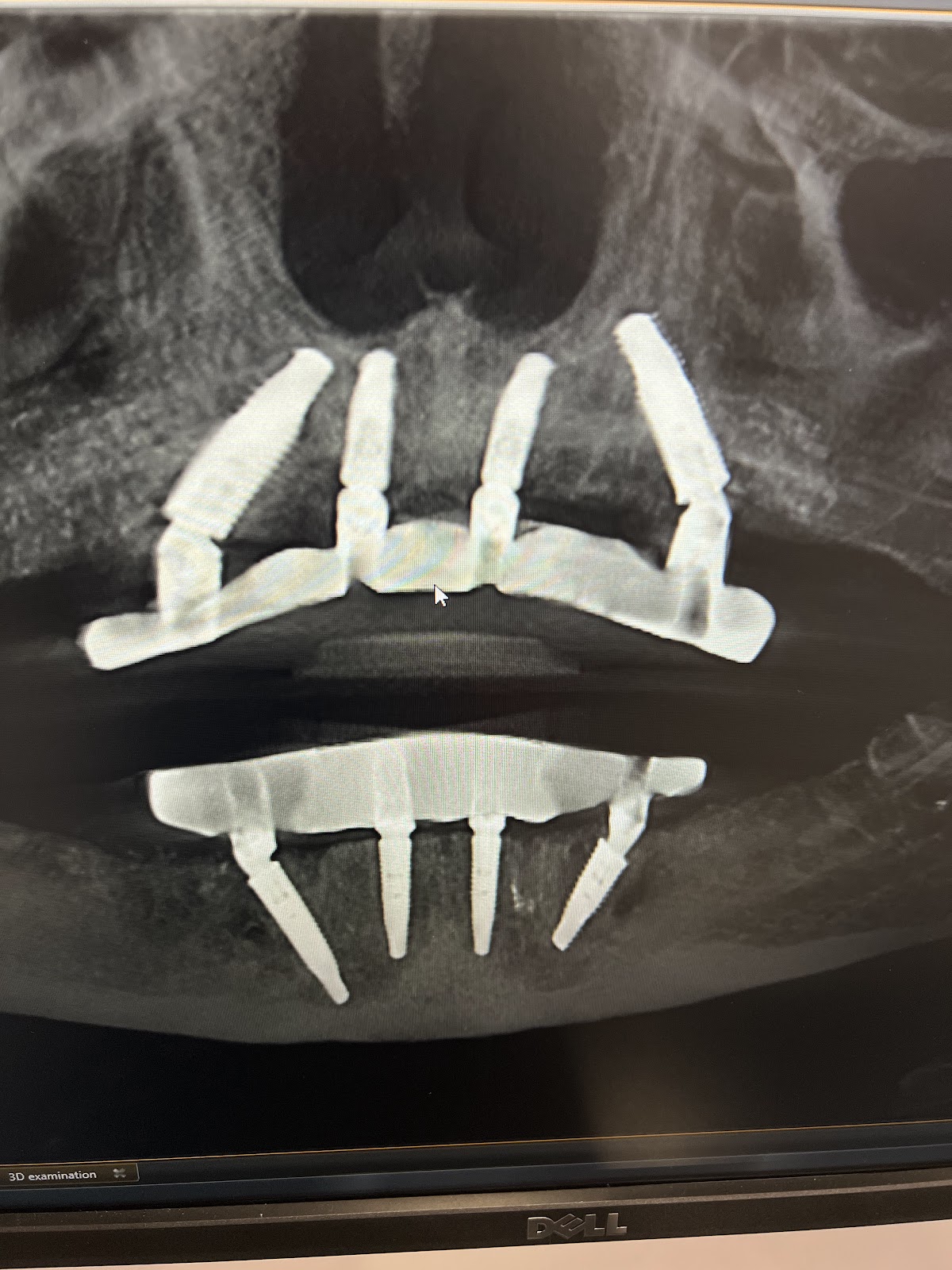 Digital Dental Implant Center photo 2