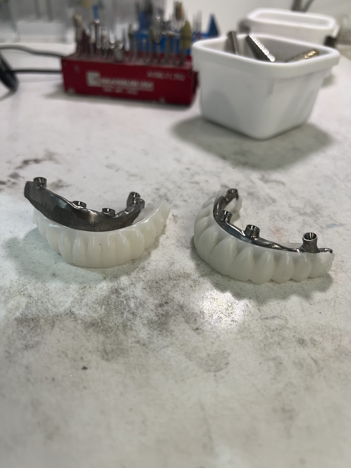 Digital Dental Implant Center photo 3