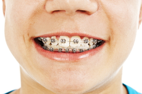 Element Dental & Orthodontics Conroe photo 1