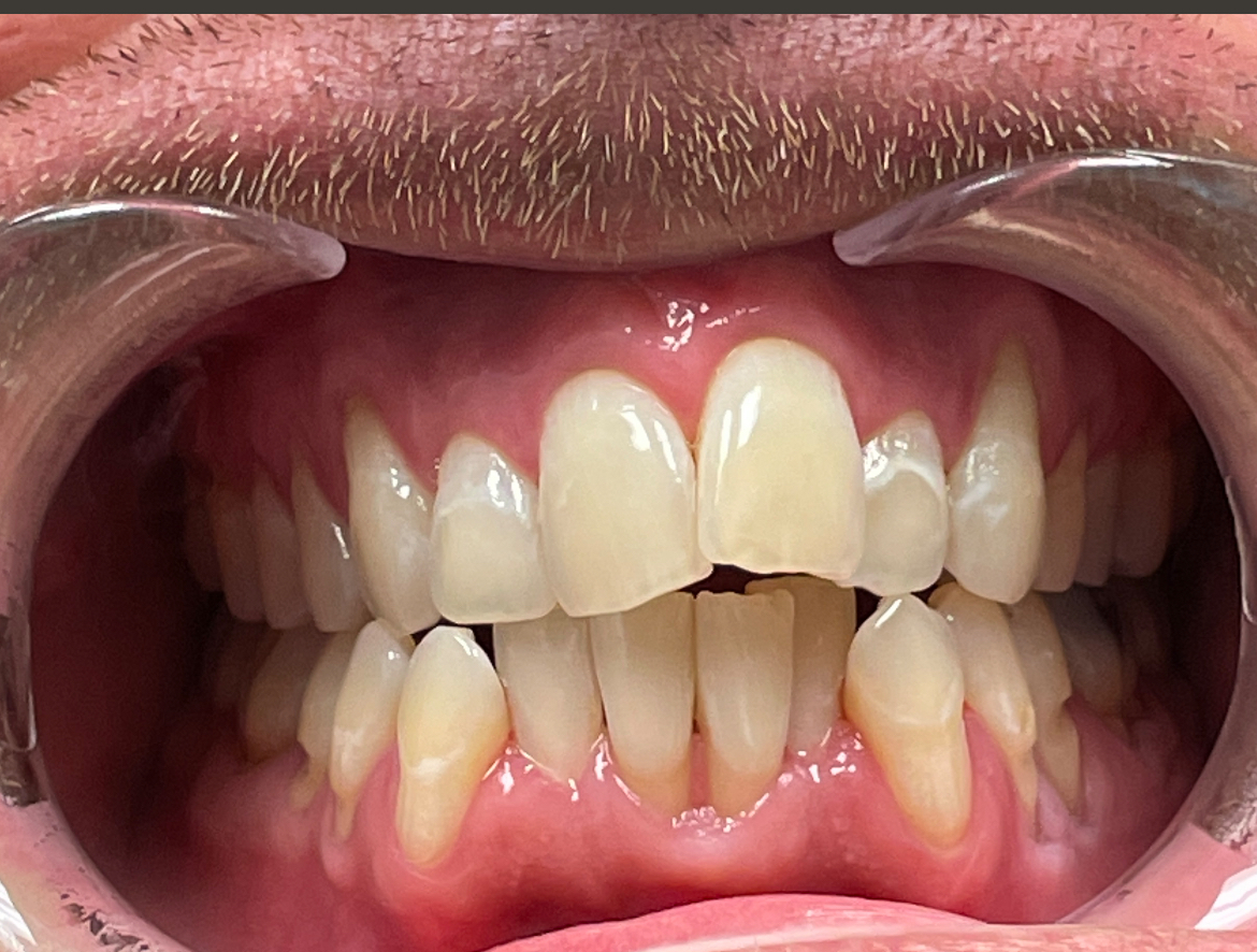 Restoration Dental photo 2