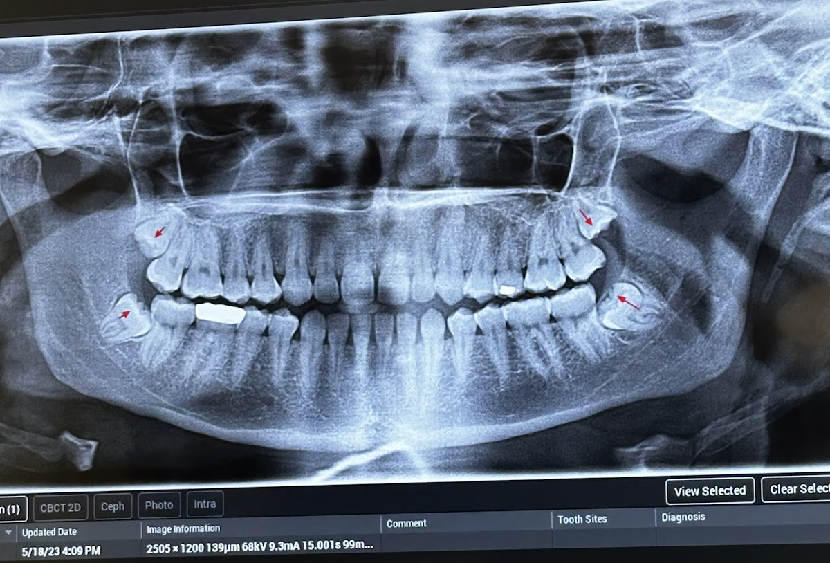 Implants & Oral Surgery of Chattanooga photo 3