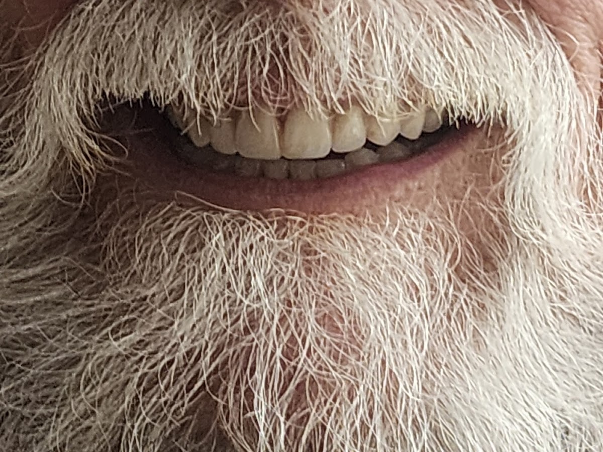 Affordable Dentures & Implants - Sullivan photo 2