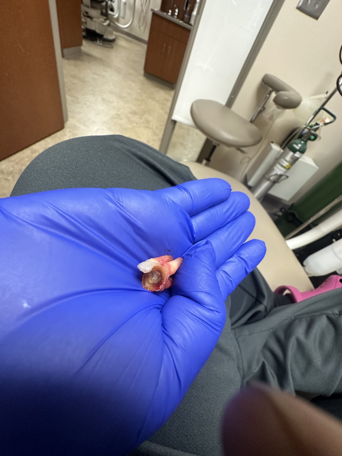 Aspen Dental - Douglasville photo 3