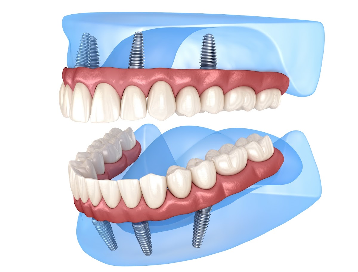 New Smile Now -home of the Facial Surgery Center photo 3