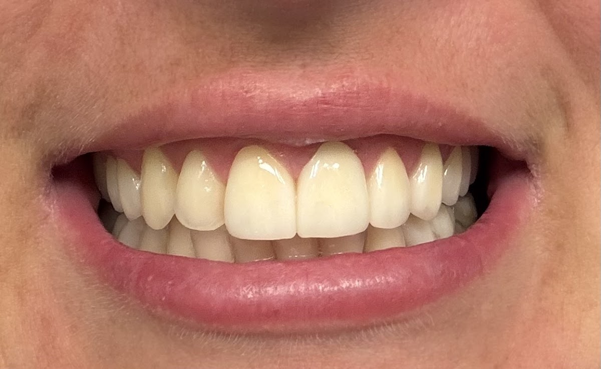 Prosthodontics and Implant Therapy Tampa photo 3