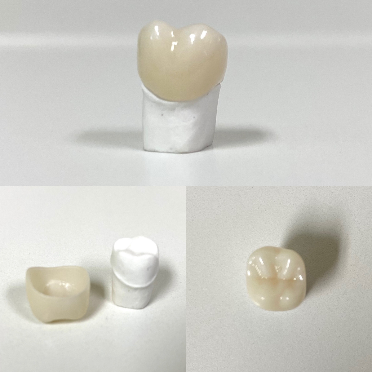 Family Tree Dental - Colegate photo 4
