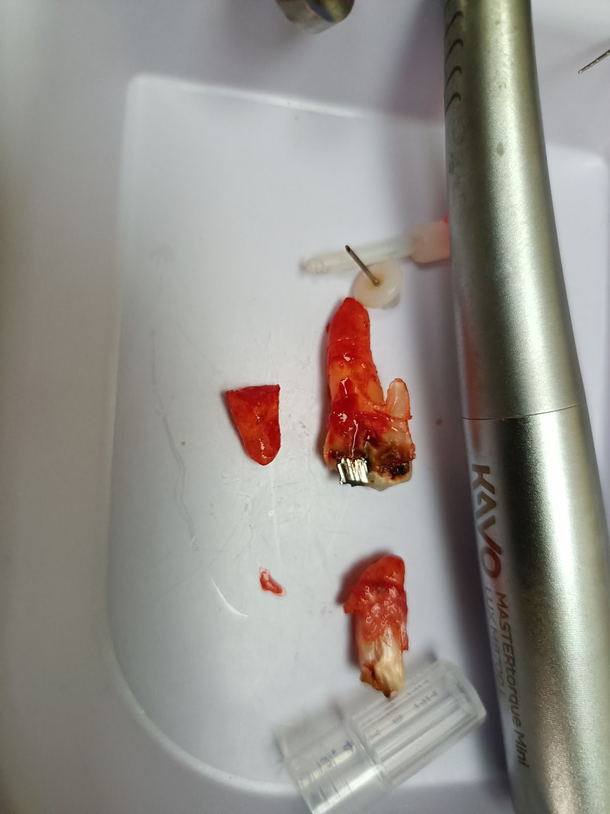 Family Tree Dental - Colegate photo 5