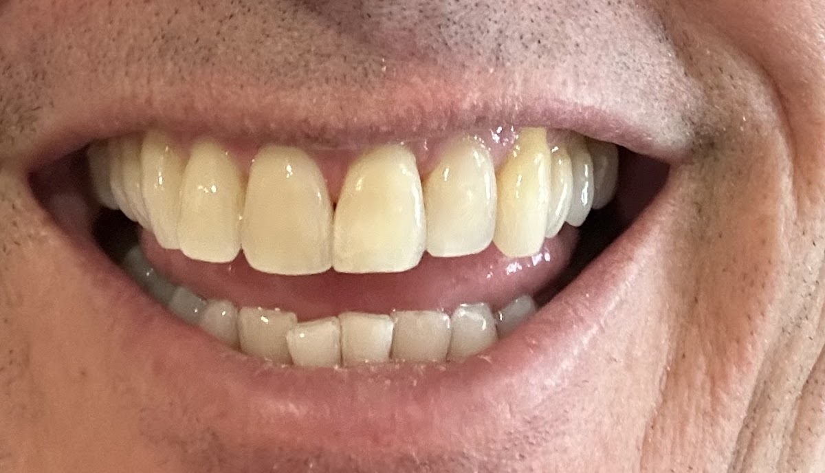 Cornerstone Dental photo 5