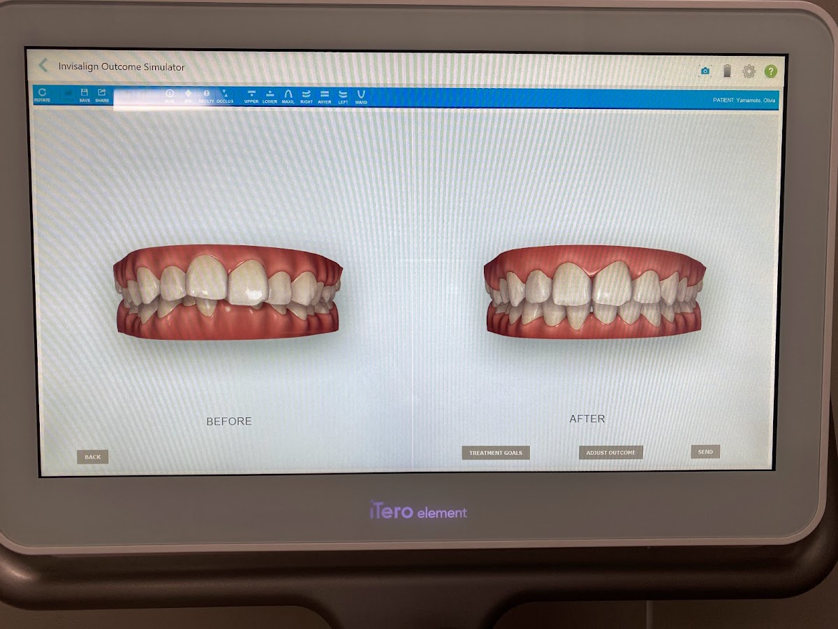 Dr. Claire Kang: Same-day Crowns and Implants photo 2