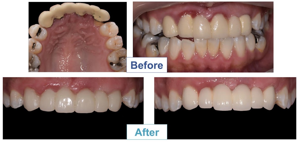 Dr. Claire Kang: Same-day Crowns and Implants photo 6