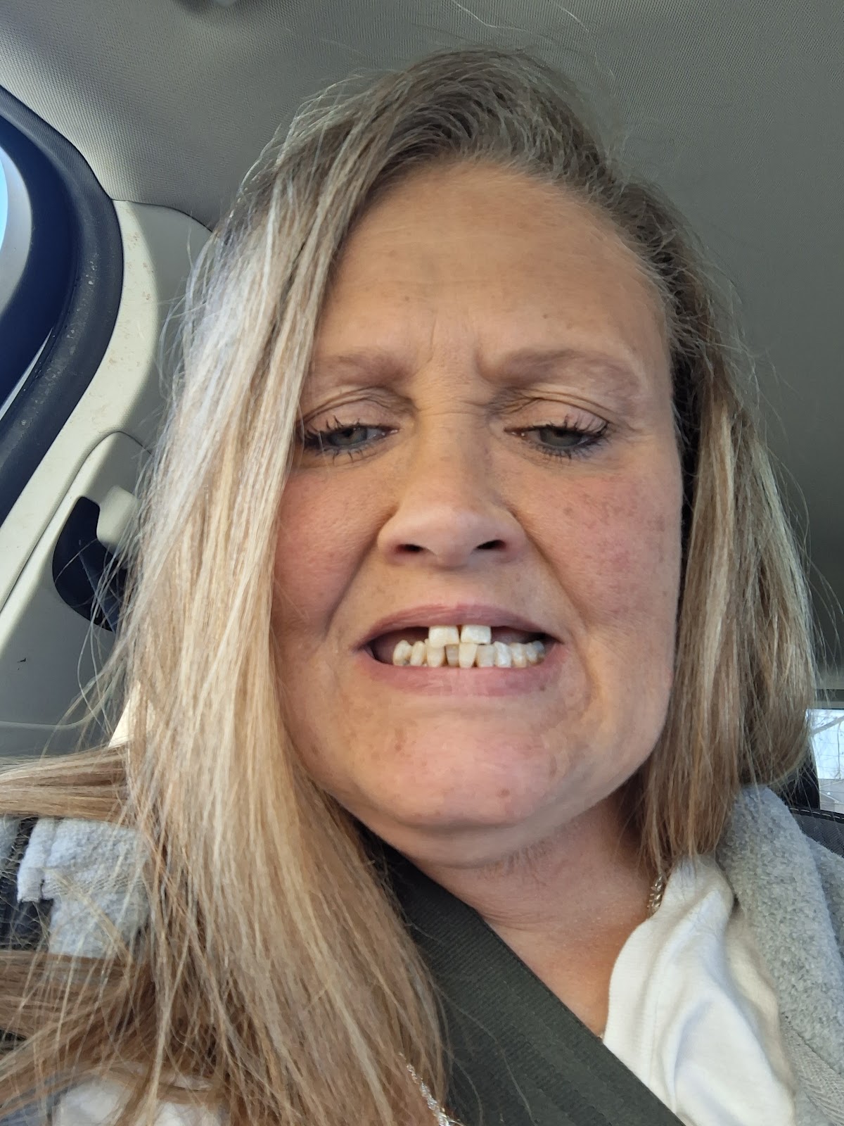 Aspen Dental - Midland photo 5