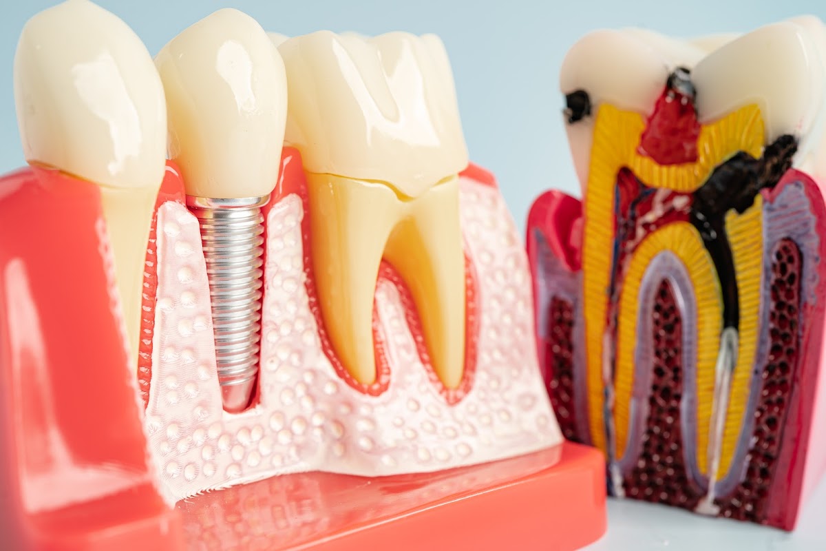 Spark Family Dental, Tracy photo 3