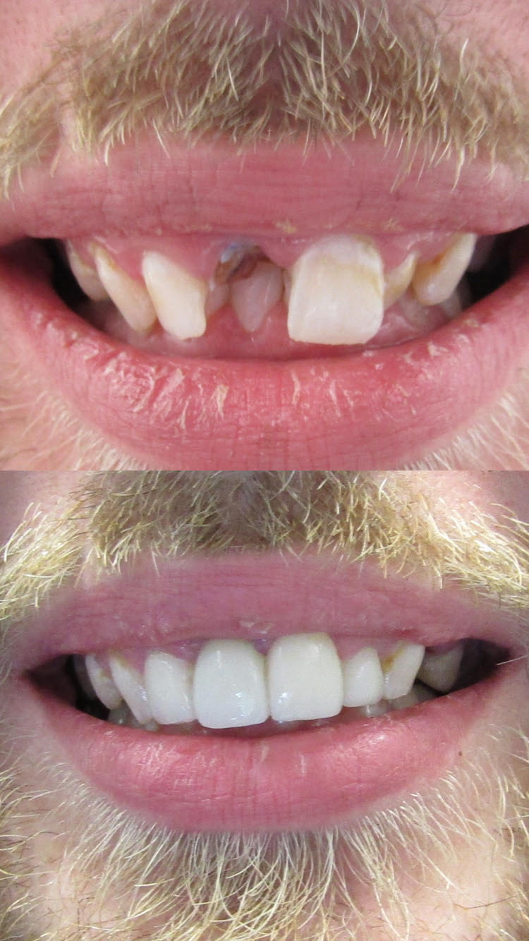 Gabhart Family Dentistry photo 5