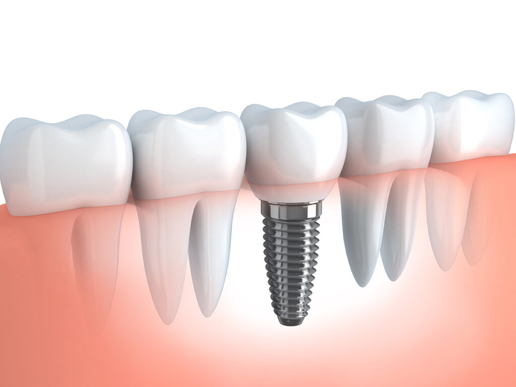A+ Dental photo 2