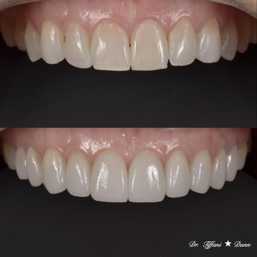 Kona Smile Co. by Dr. Tiffani Dunn photo 2