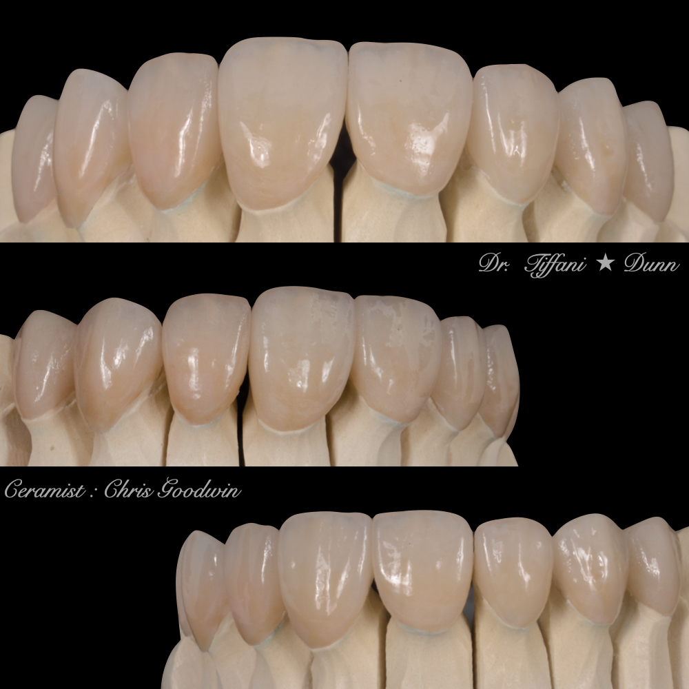 Kona Smile Co. by Dr. Tiffani Dunn photo 6