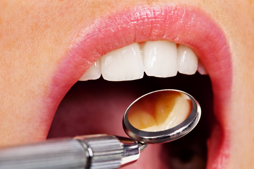 Dr. Sheard A. Ber, DDS General & Cosmetic Dentistry photo 5