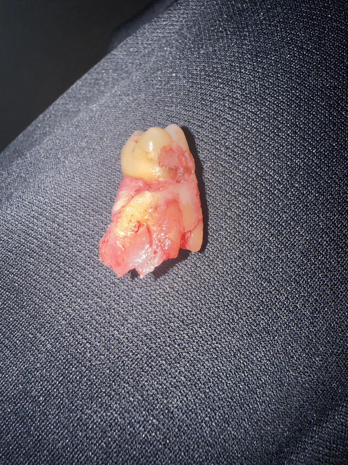 Community Dental Care - Rochester photo 5