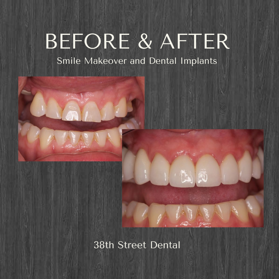 38th Street Dental photo 5