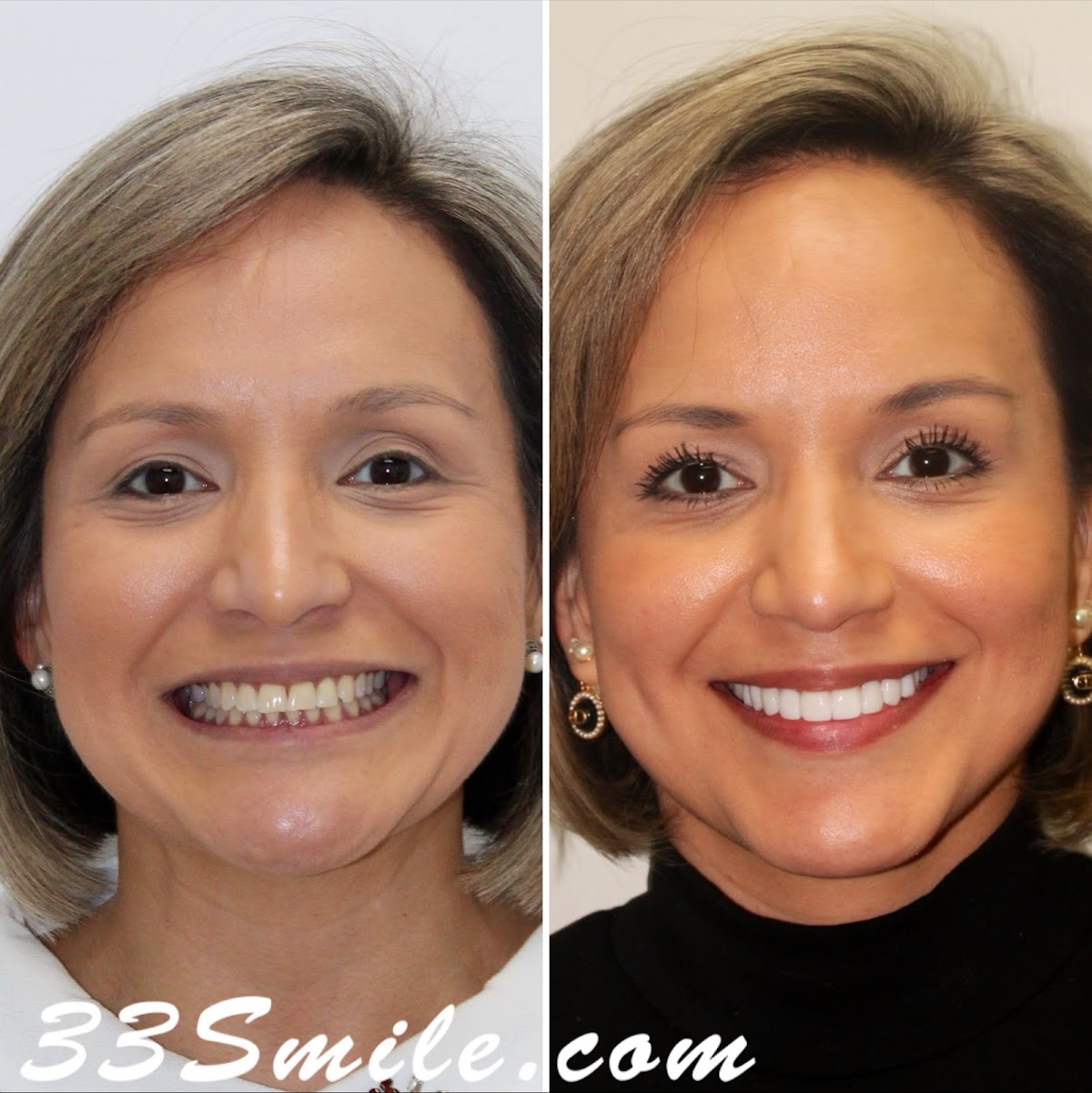 Cosmetic Dental Associates - Alamo Ranch photo 1