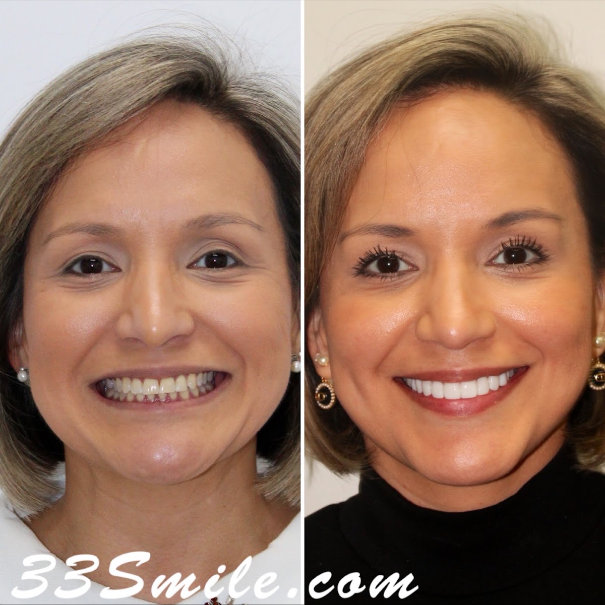 Cosmetic Dental Associates - Alamo Ranch photo 1