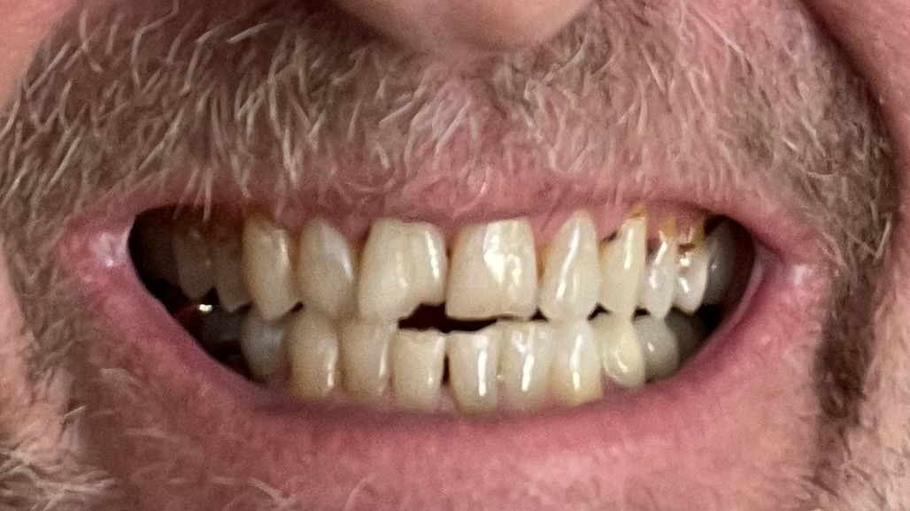 Affordable Dentures & Implants - Loudon photo 3