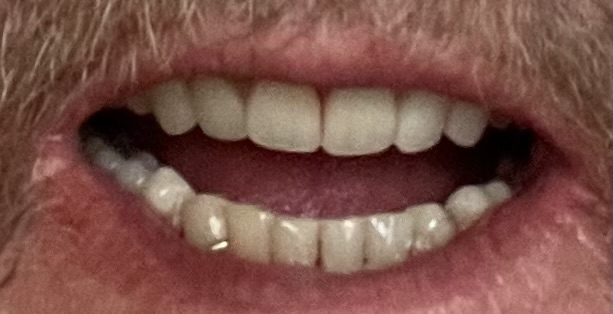 Affordable Dentures & Implants - Loudon photo 5