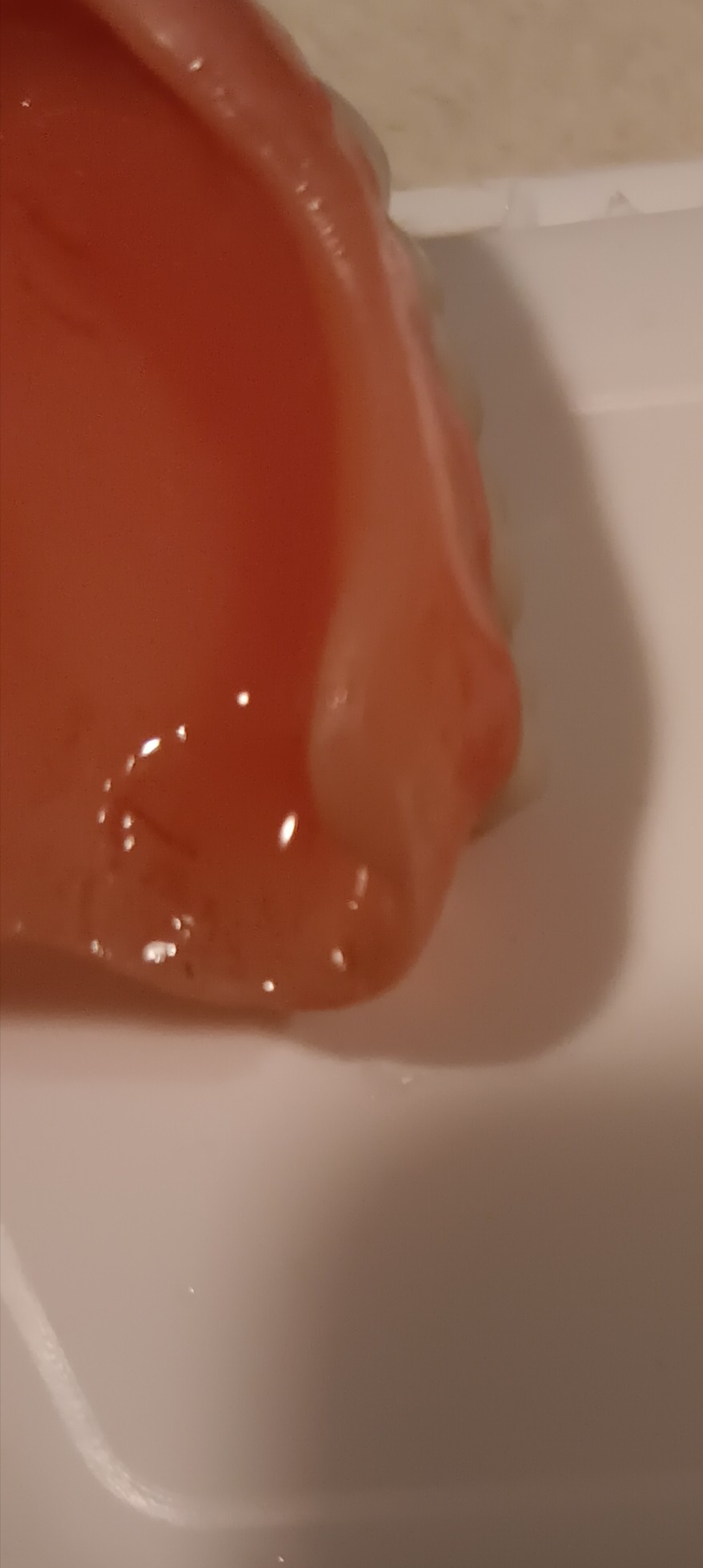 Affordable Dentures & Implants - Lakewood photo 6