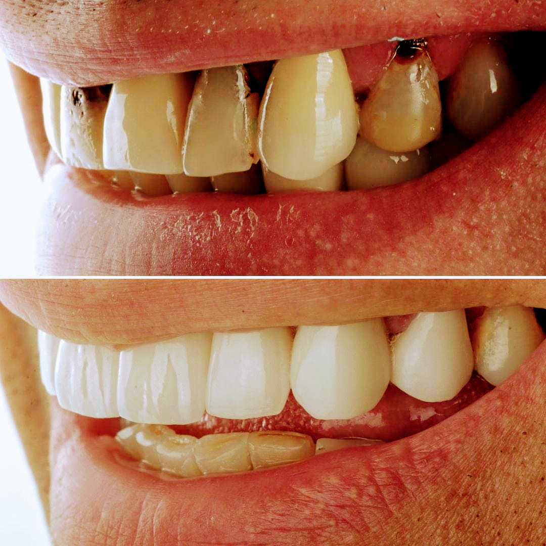 Implant Denture and Dental Center photo 1