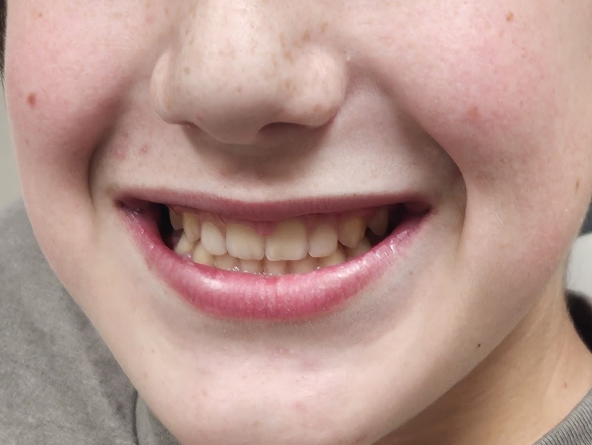 The Oak Mountain Denture and Implant Center photo 5