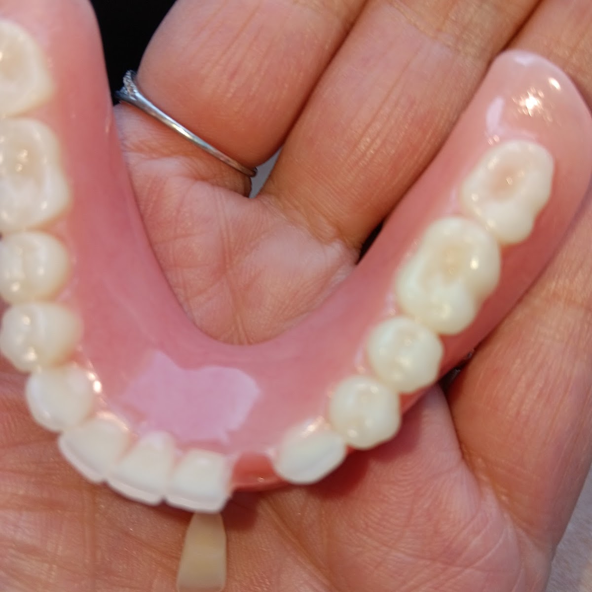 Aspen Dental - Gresham photo 6