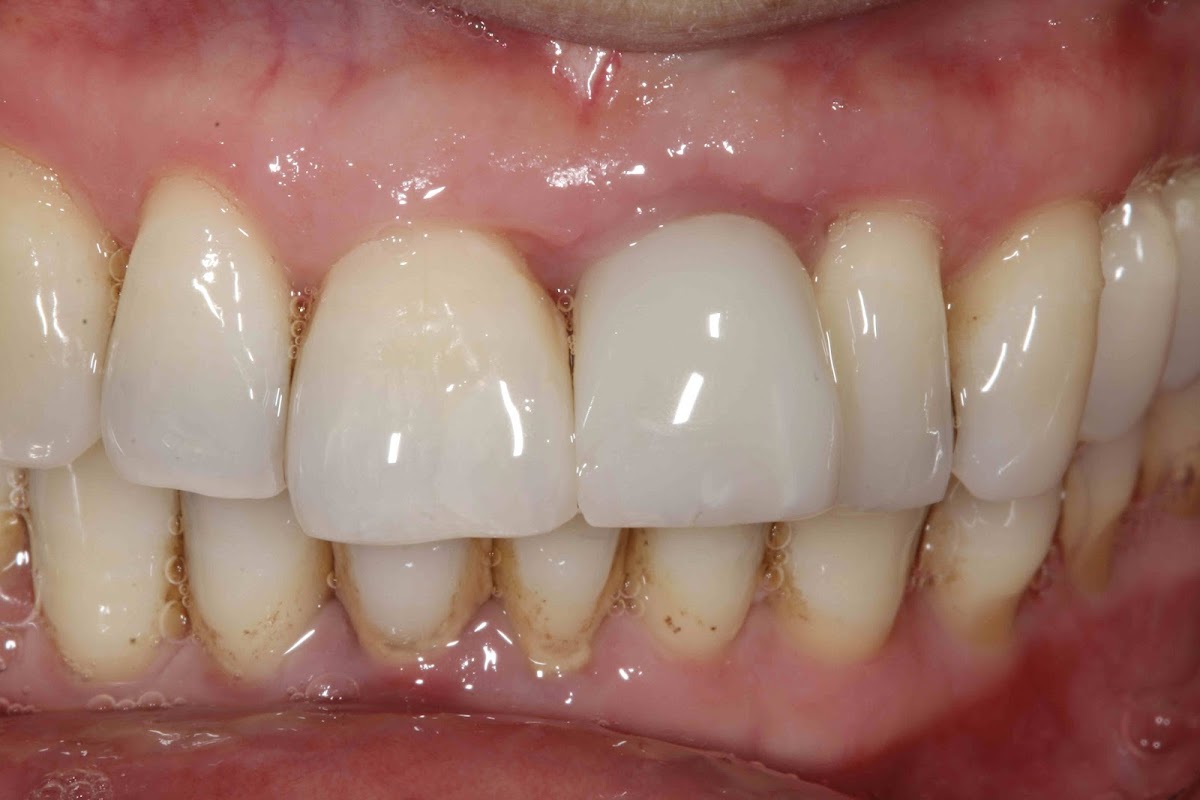 Implantasmile.Com photo 2