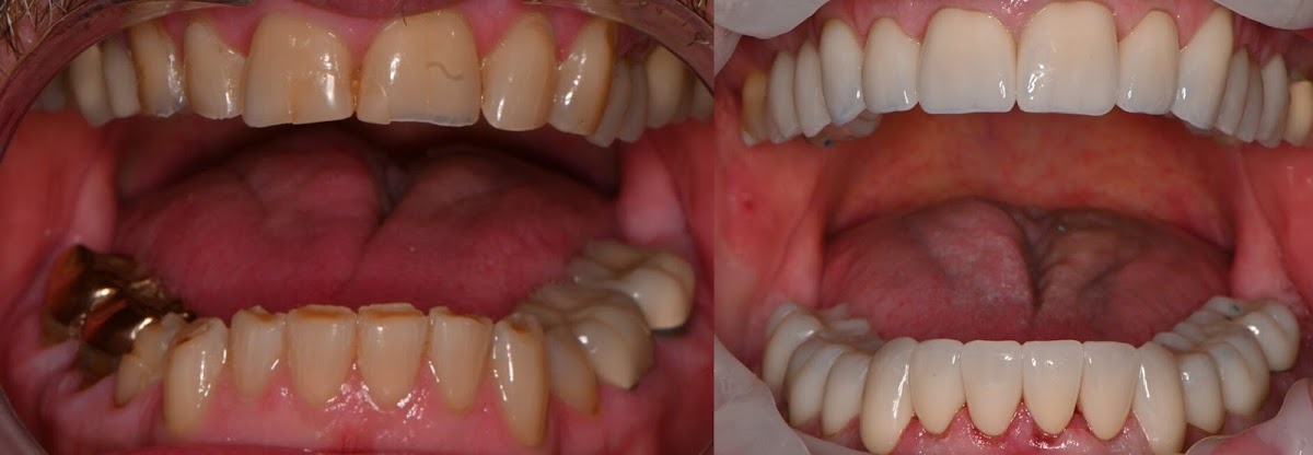 Tyler And Yun Family Dental photo 2