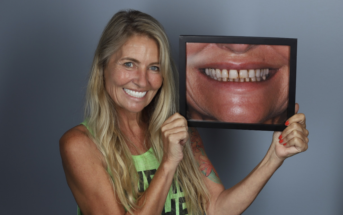 Esteem Dental Implants photo 3