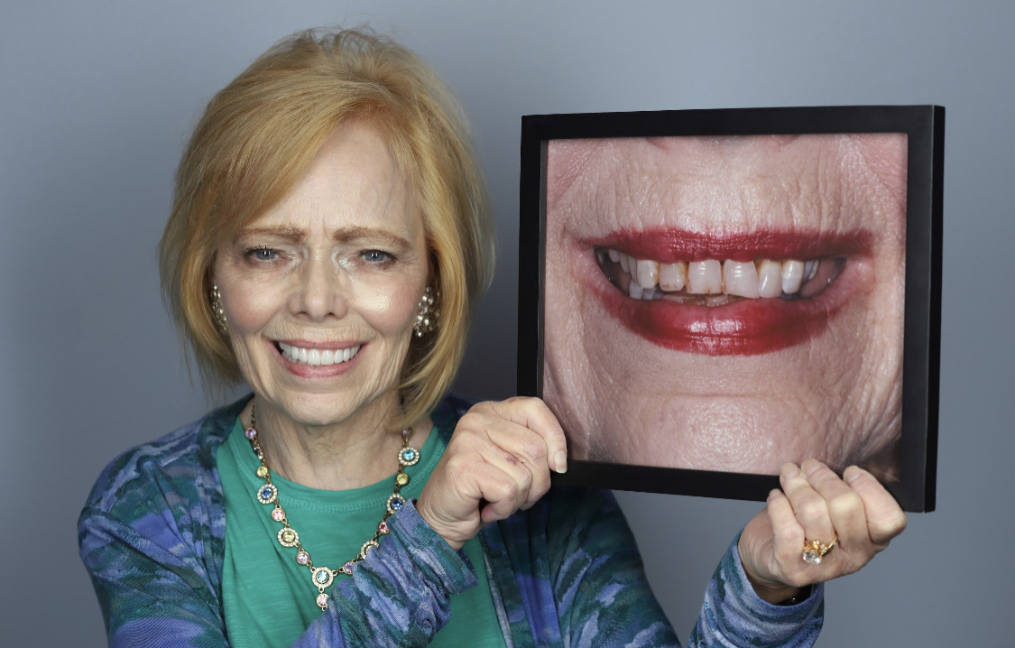 Esteem Dental Implants photo 6