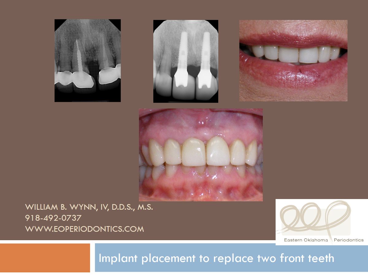 Eastern Oklahoma Periodontics: Wynn William B DDS photo 6