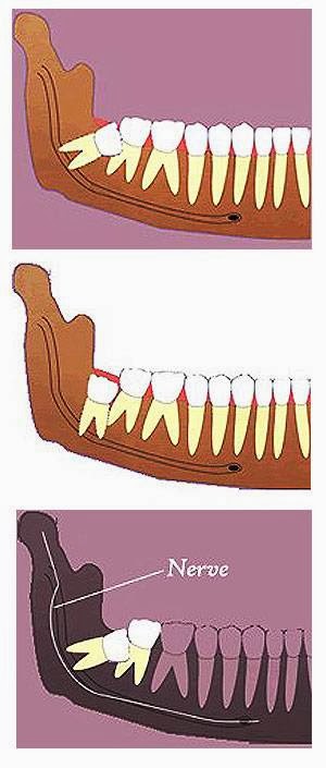Strull Oral Surgery photo 4