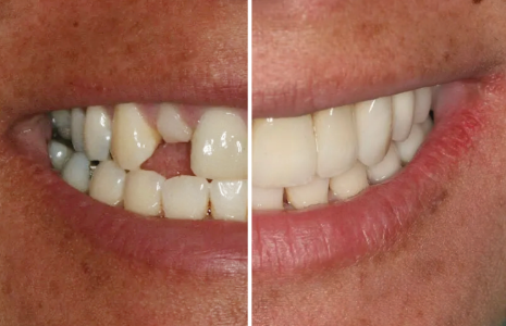 Northern Colorado Dental and Implant Center photo 3