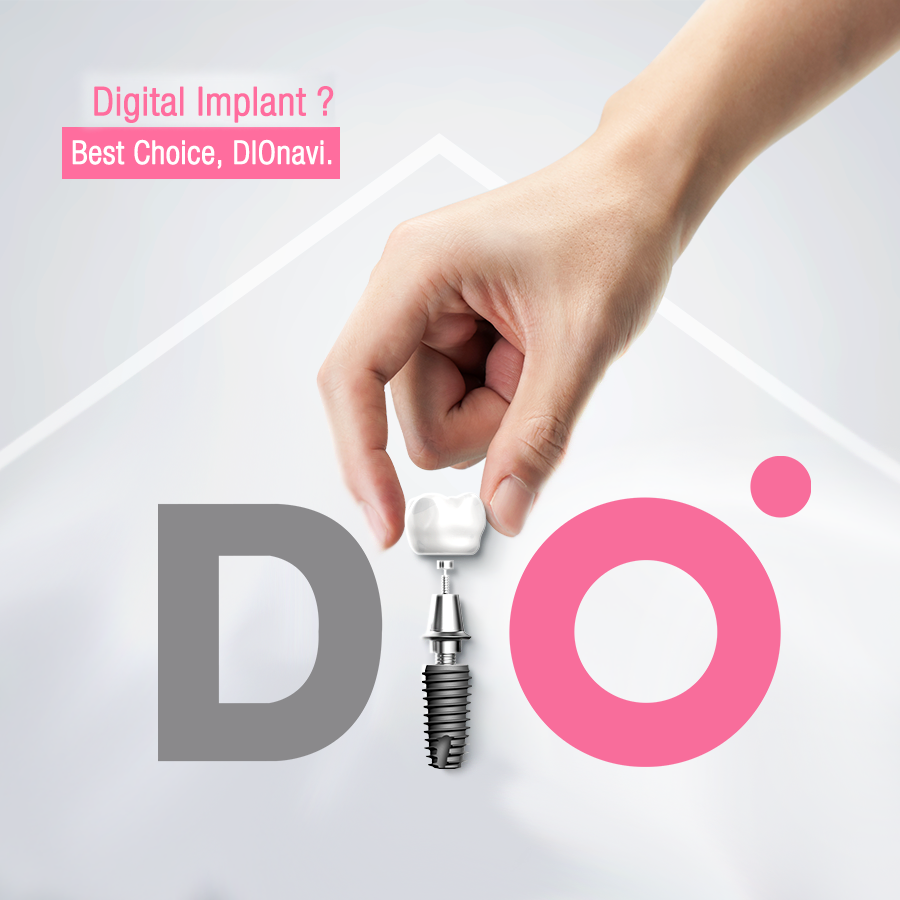 Dio Implant Usa photo 2