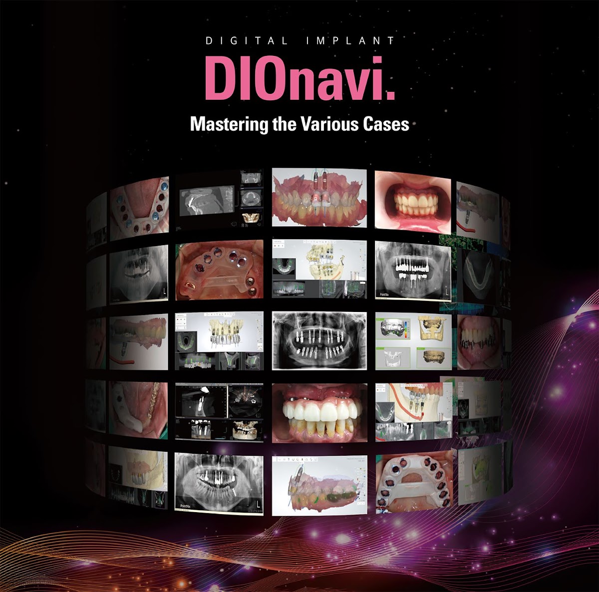 Dio Implant Usa photo 3