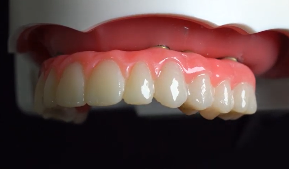 Dio Implant Usa photo 6