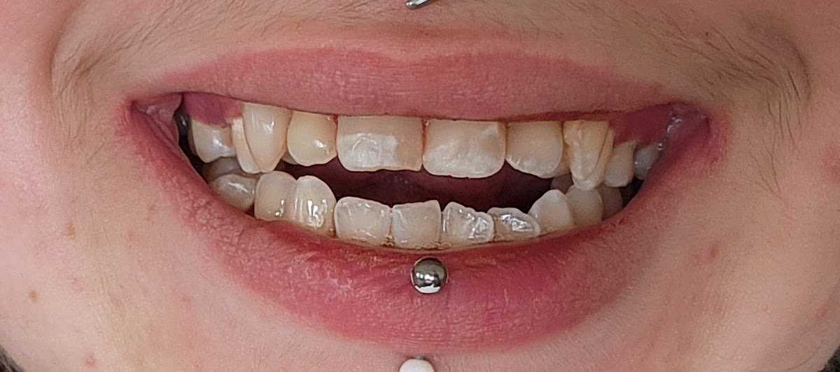 Aspen Dental - Easton, Md photo 5