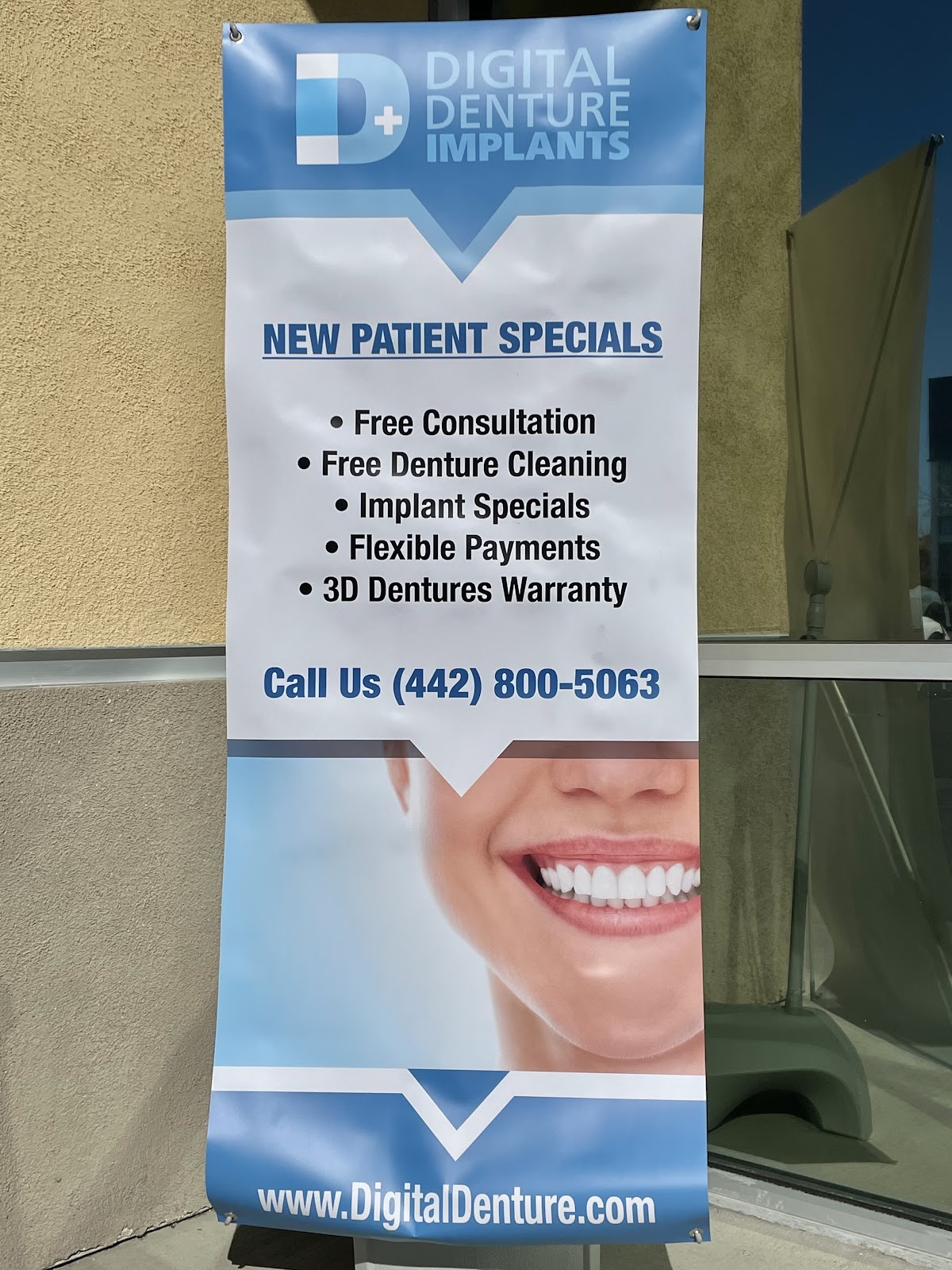 Digital Denture + Implants photo 6