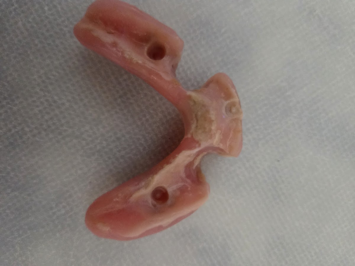 Affordable Dentures & Implants - Folsom photo 3