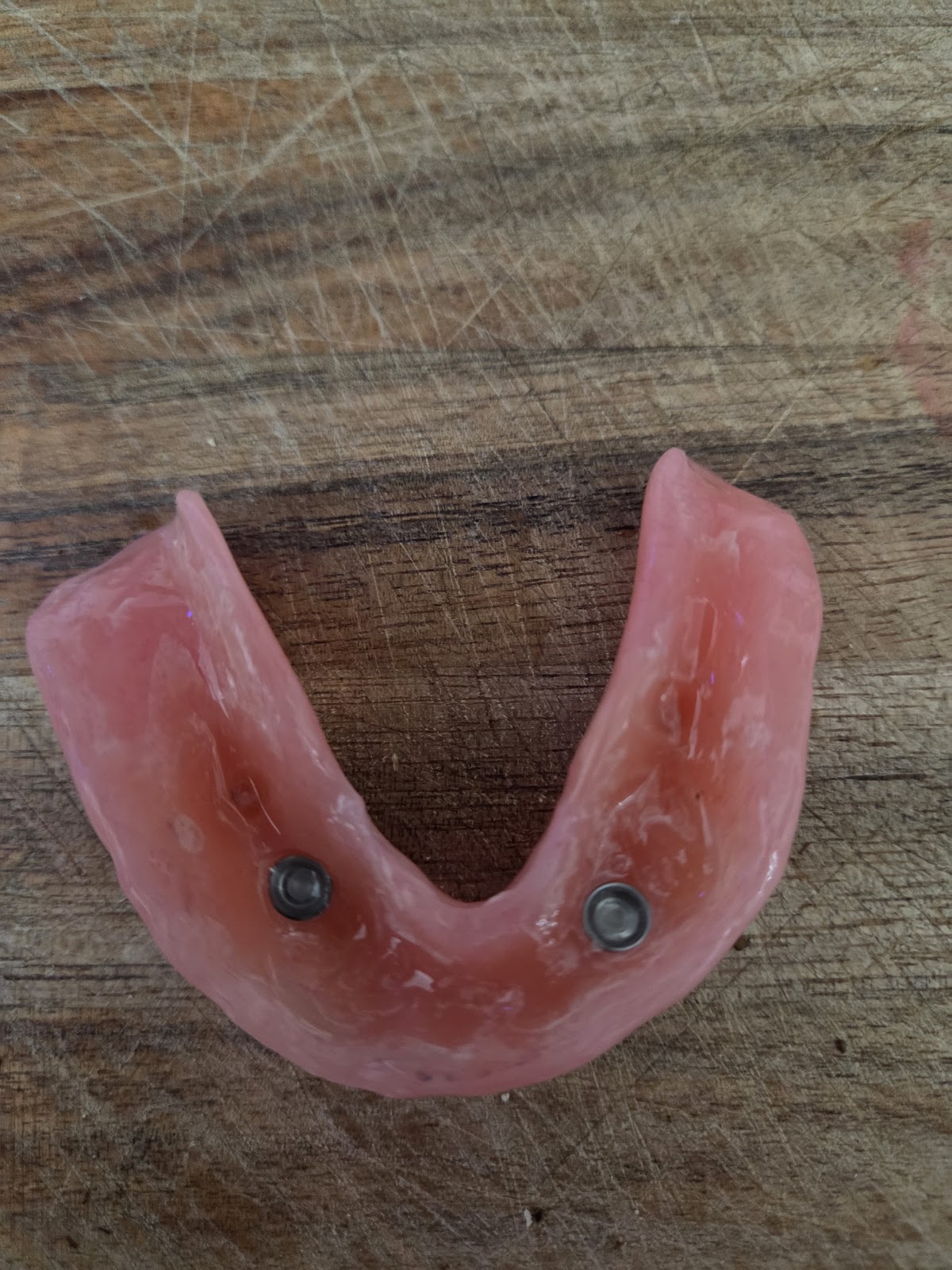 Affordable Dentures & Implants - Folsom photo 5