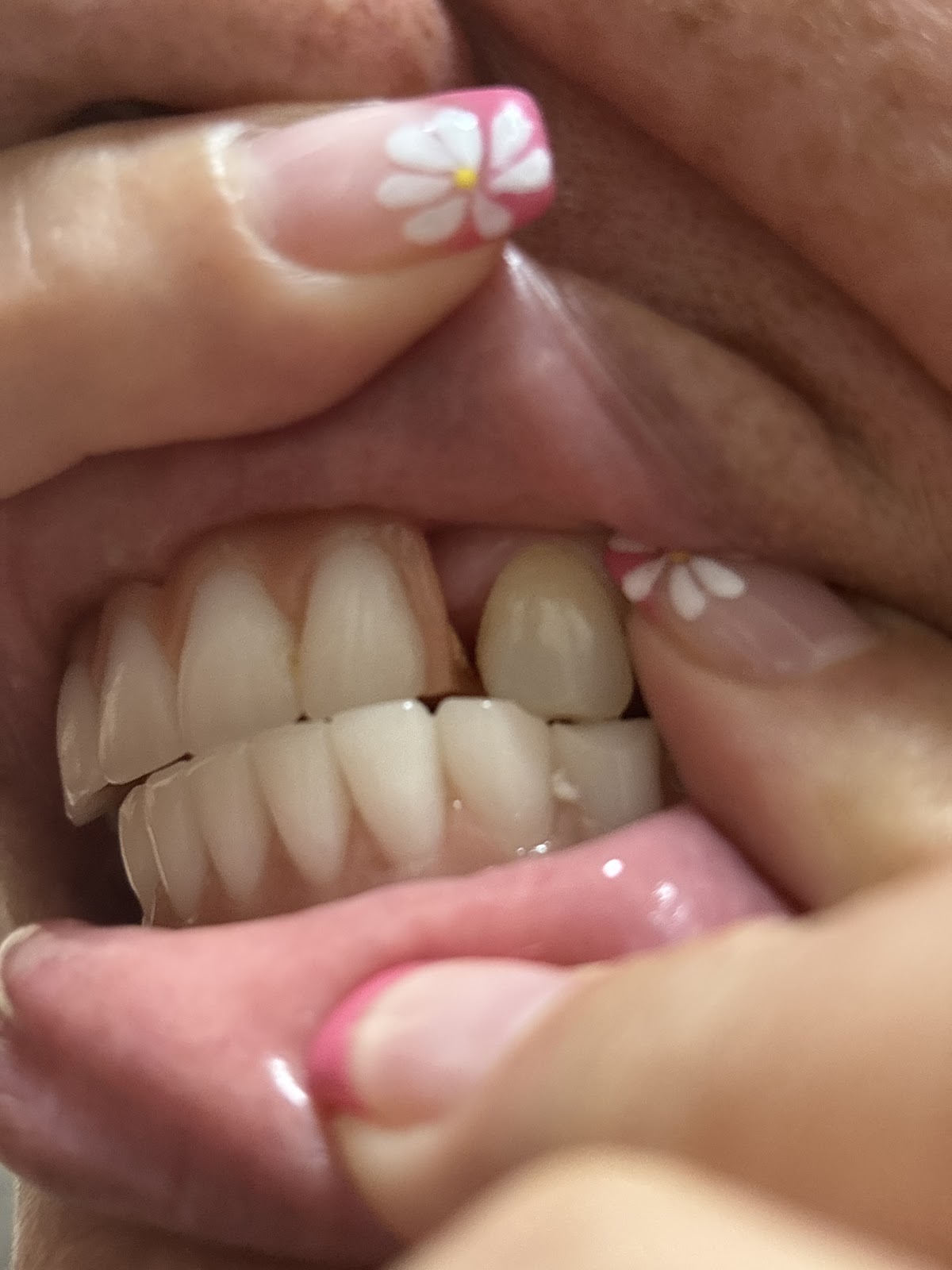 Affordable Dentures & Implants - North Dallas photo 4